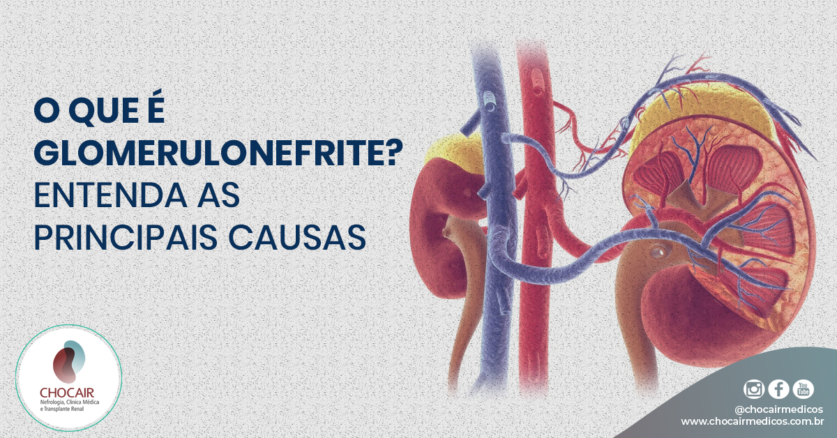 O que é glomerulonefrite? Entenda as principais causas – Chocair Médicos