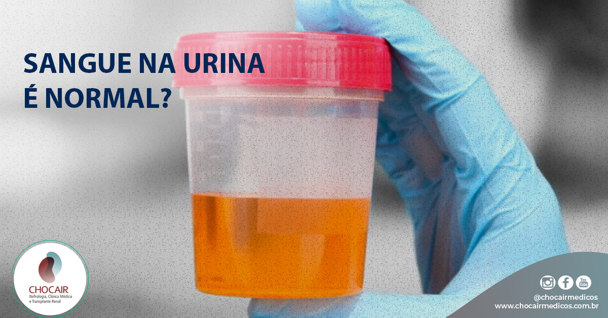 Eliminare Cheaguri De Sange In Urina Sangue na urina é normal? – Chocair Médicos