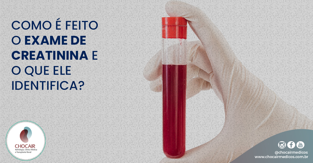 Como é Feito O Exame De Creatinina E O Que Ele Identifica Chocair Médicos 6894